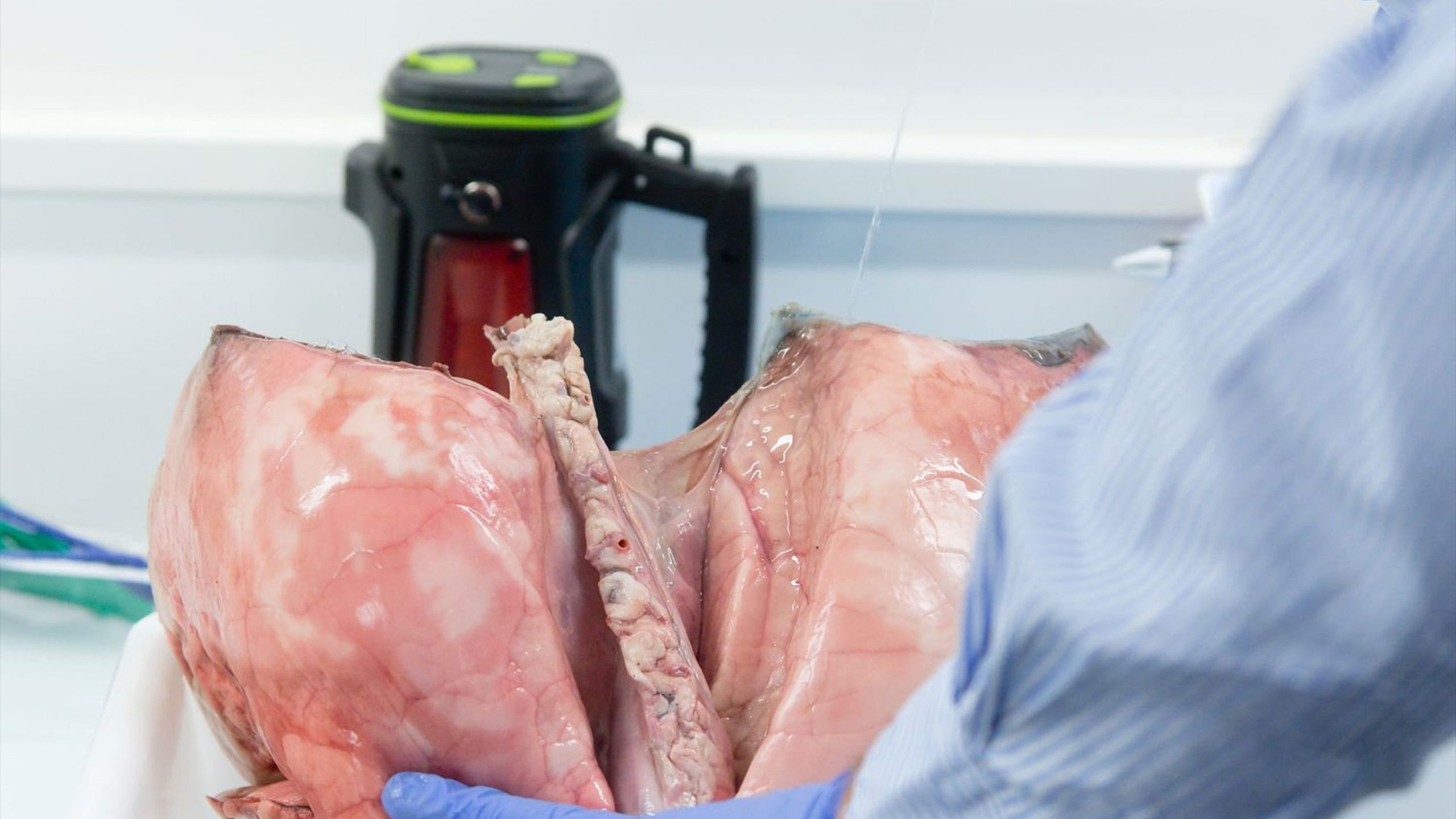 INNOVATION : COHESIVES développe un adhésif pour renforcer l’étanchéification des sutures en chirurgie 