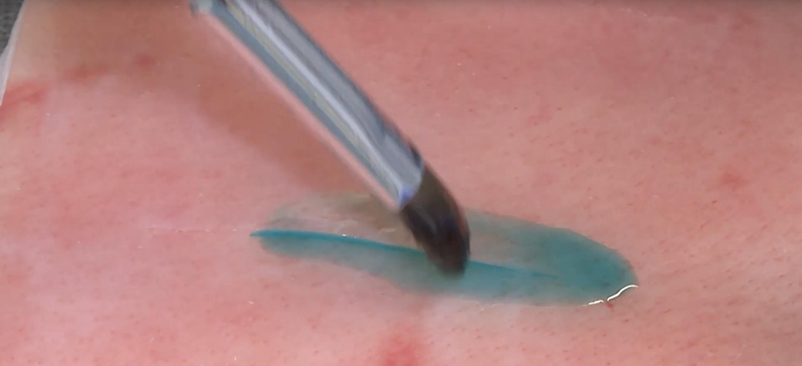 AnCore Adhesion biometrique